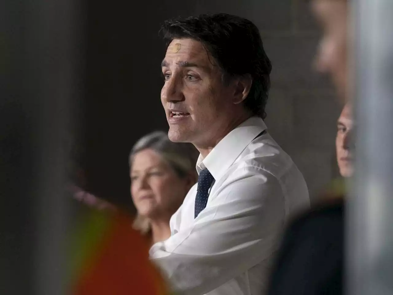 Trudeau appeared at news conference with bandage on forehead