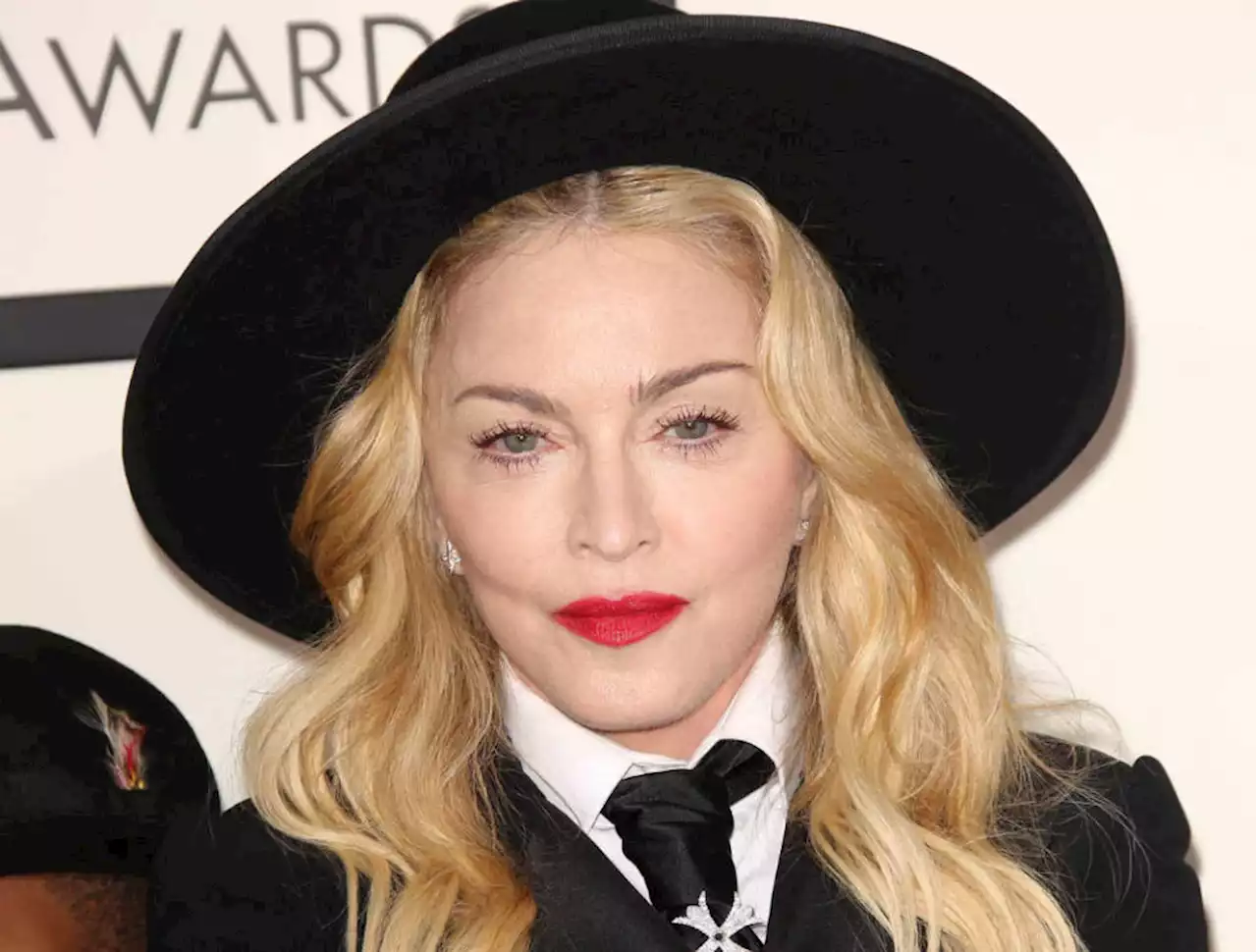 Madonna Mengaku Beruntung Tetap Hidup Setelah Alami Infeksi Bakteri Serius