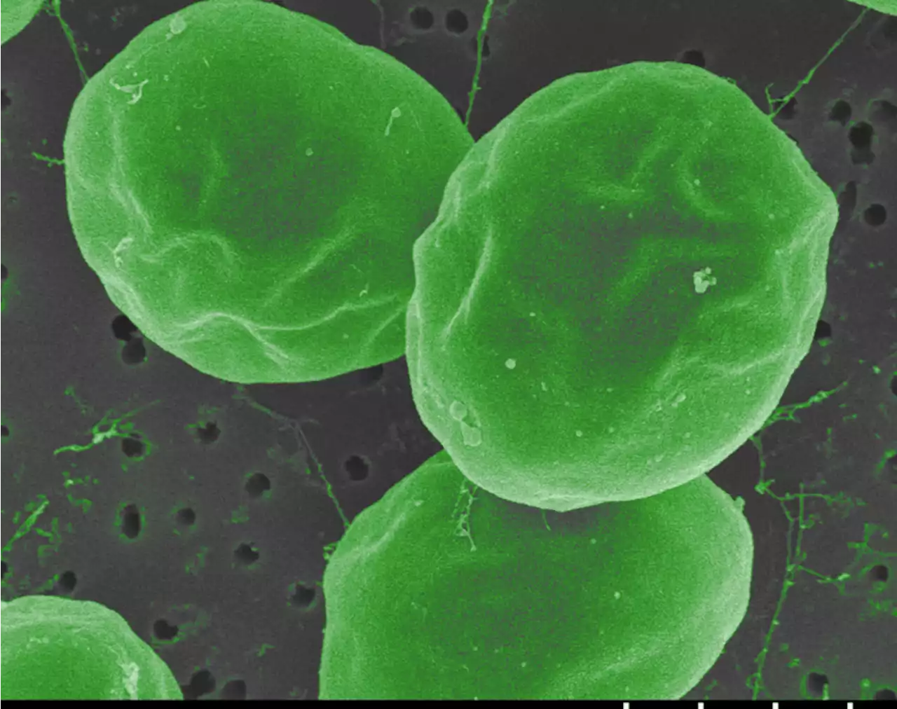 Microalgae vs. Mercury - CleanTechnica
