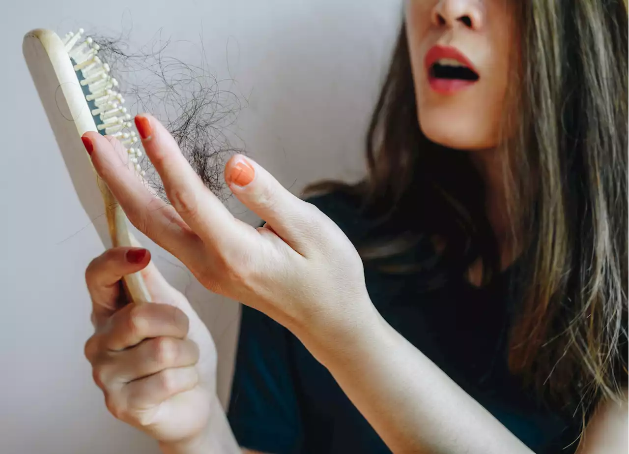 Si se soñó con que se le cae el cabello, su subconsciente le tiene preocupantes señales - Pulzo