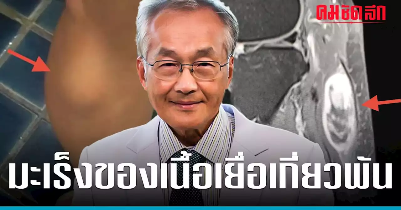 'หมอมนูญ' เตือน คลำเจอแบบนี้อย่าวางใจ รีบพบแพทย์ เสี่ยงโรคร้าย