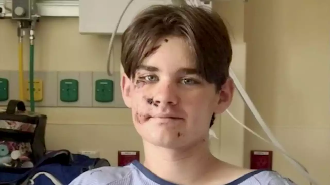 Teen Survives Terrifying 100-Foot Fall at the Grand Canyon