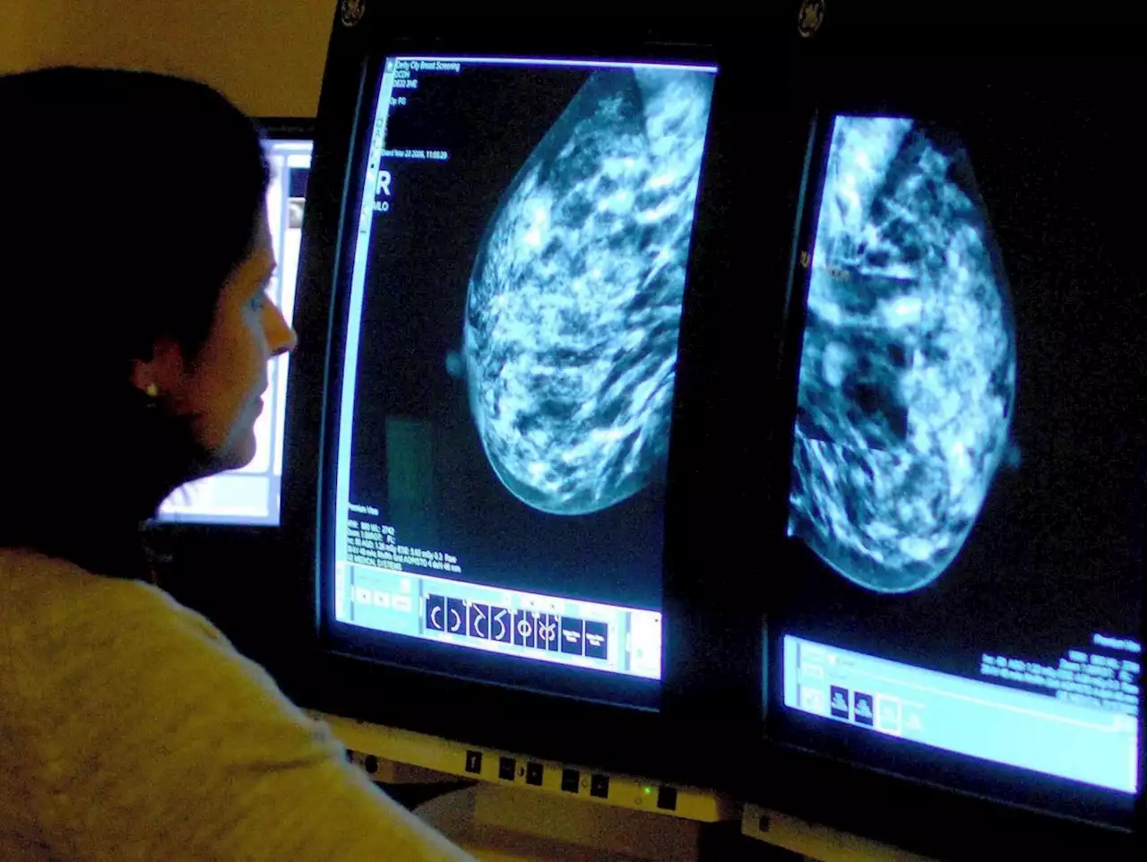 Why proposal to scrap cancer targets masks the real problems in the NHS