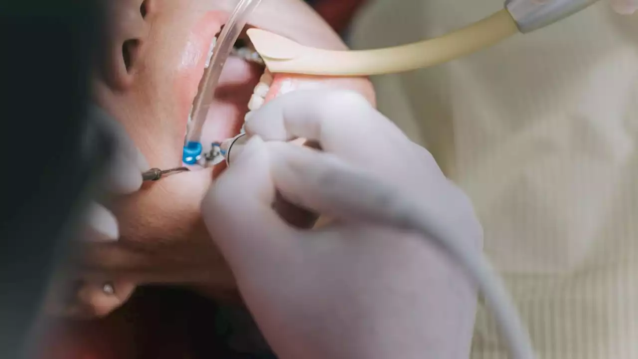 'Takes time and experience to do well': Why root canal treatments can cost thousands of dollars