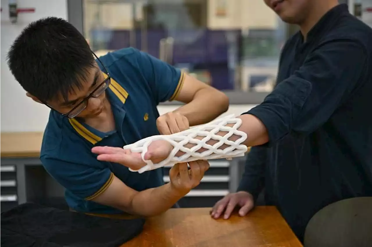 Start-up Castomize to revolutionise fracture care with 4D-printed cast