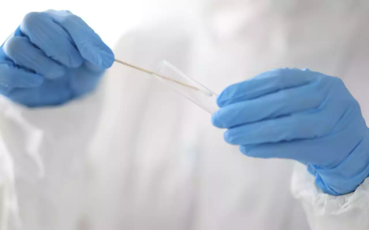 Health Dept confirms first case of COVID subvariant EG.5 in SA