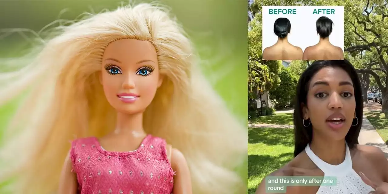 'Barbie': Diesen Körperteil lassen sich Frauen nun botoxen