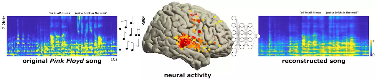 Brain recordings capture musicality of speech, with help from Pink Floyd