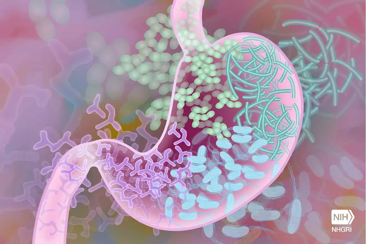 Protective particles allow engineered probiotics to report gut disease