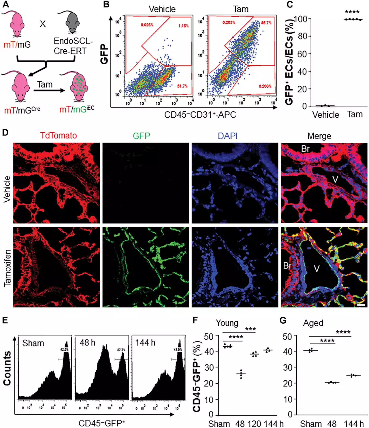 Study discovers novel therapeutic target for acute respiratory distress syndrome