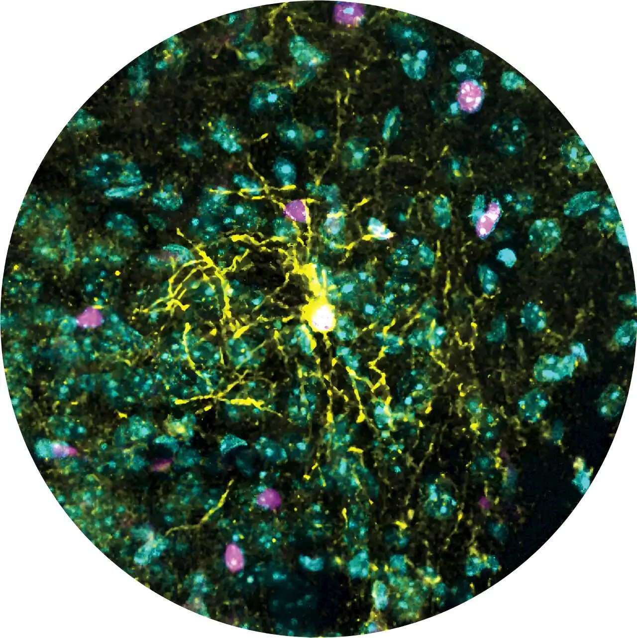 Study identifies sex differences in the brain cell types responding to stress