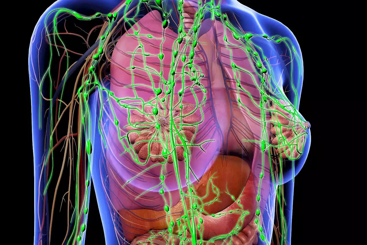 Where Breast Cancer Spreads