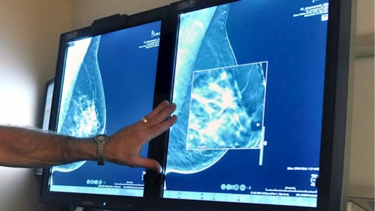 Some breast cancer patients may not need radiation, new Canadian research suggests