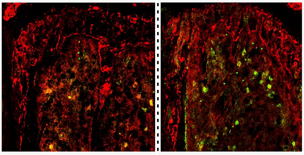 Scientists unravel how TET2 gene deficiency fuels development of acute myeloid leukemia