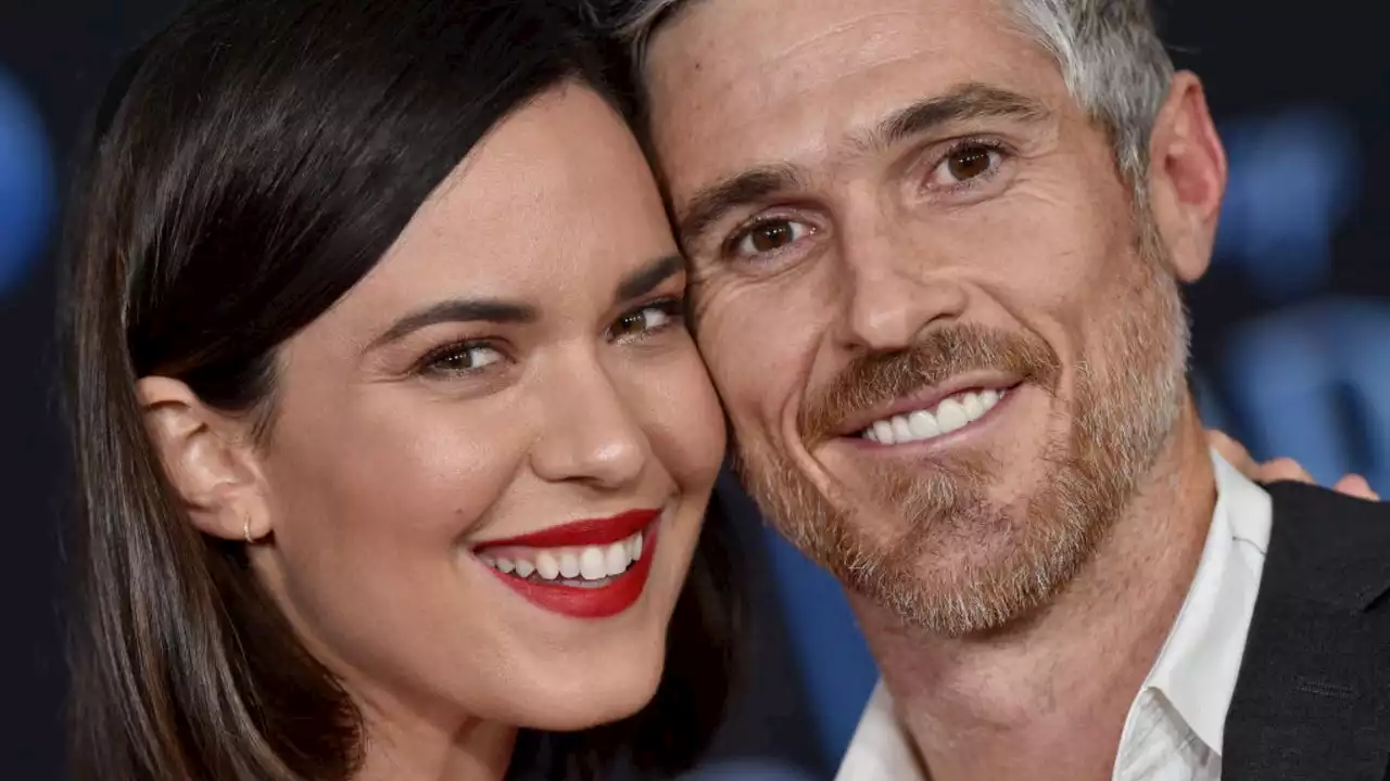 Odette Annable Hilariously Roasts Husband Dave After Dental Procedure