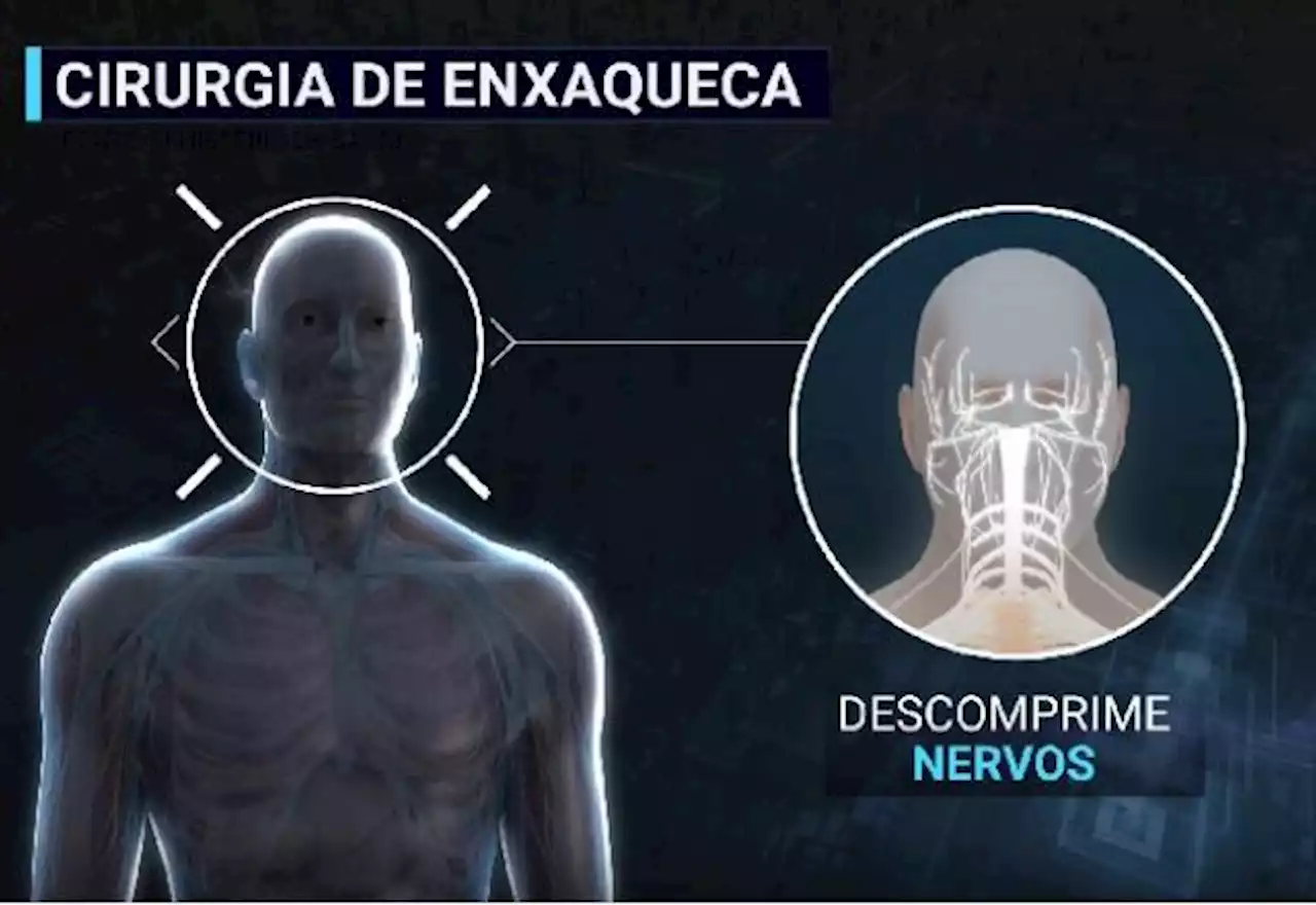 Cirurgia de descompressão de nervos: esperança para quem sofre com a enxaqueca