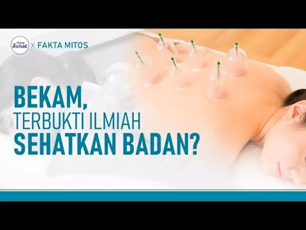 Mengenal Fungsi dan Manfaat Bekam Secara Ilmiah