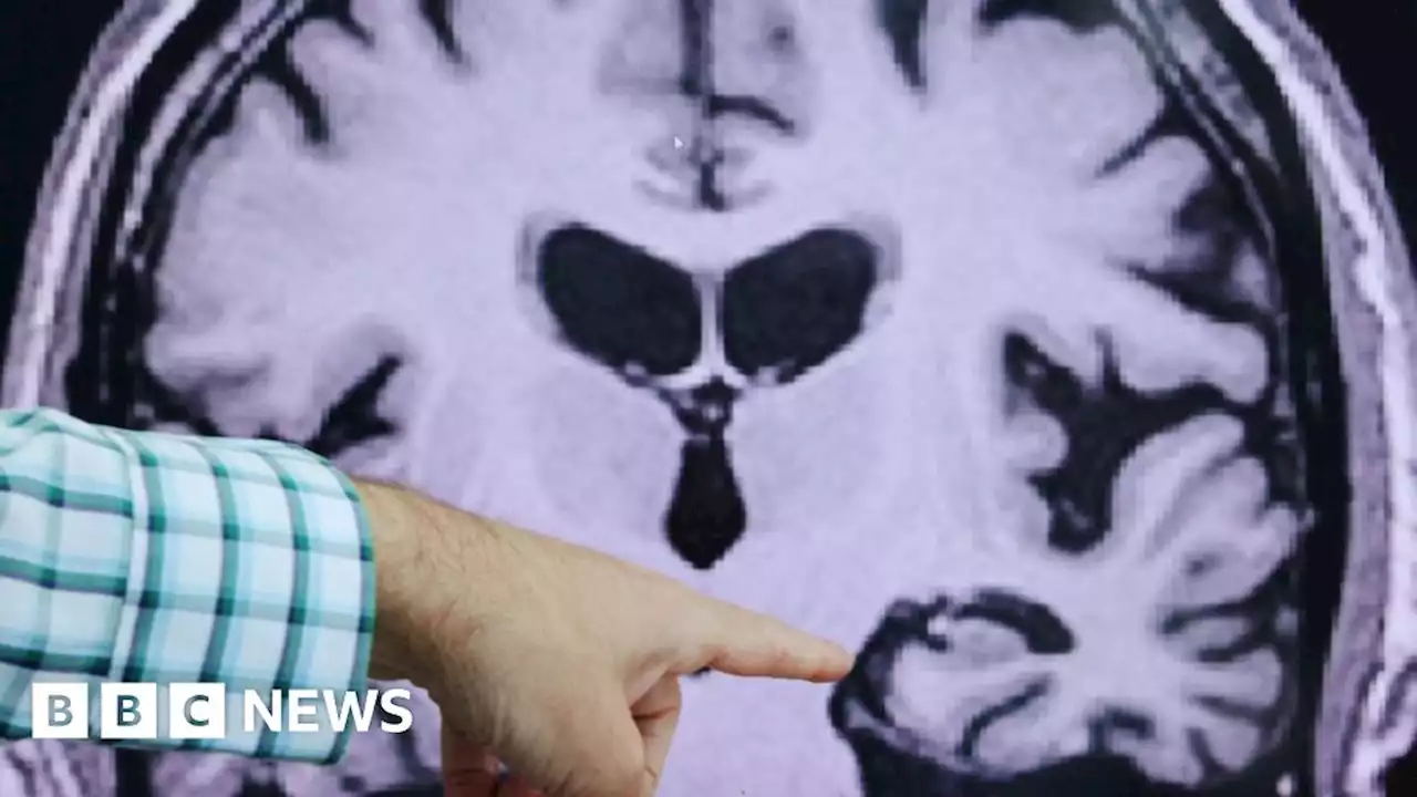 Funding to help speed up Alzheimer's research