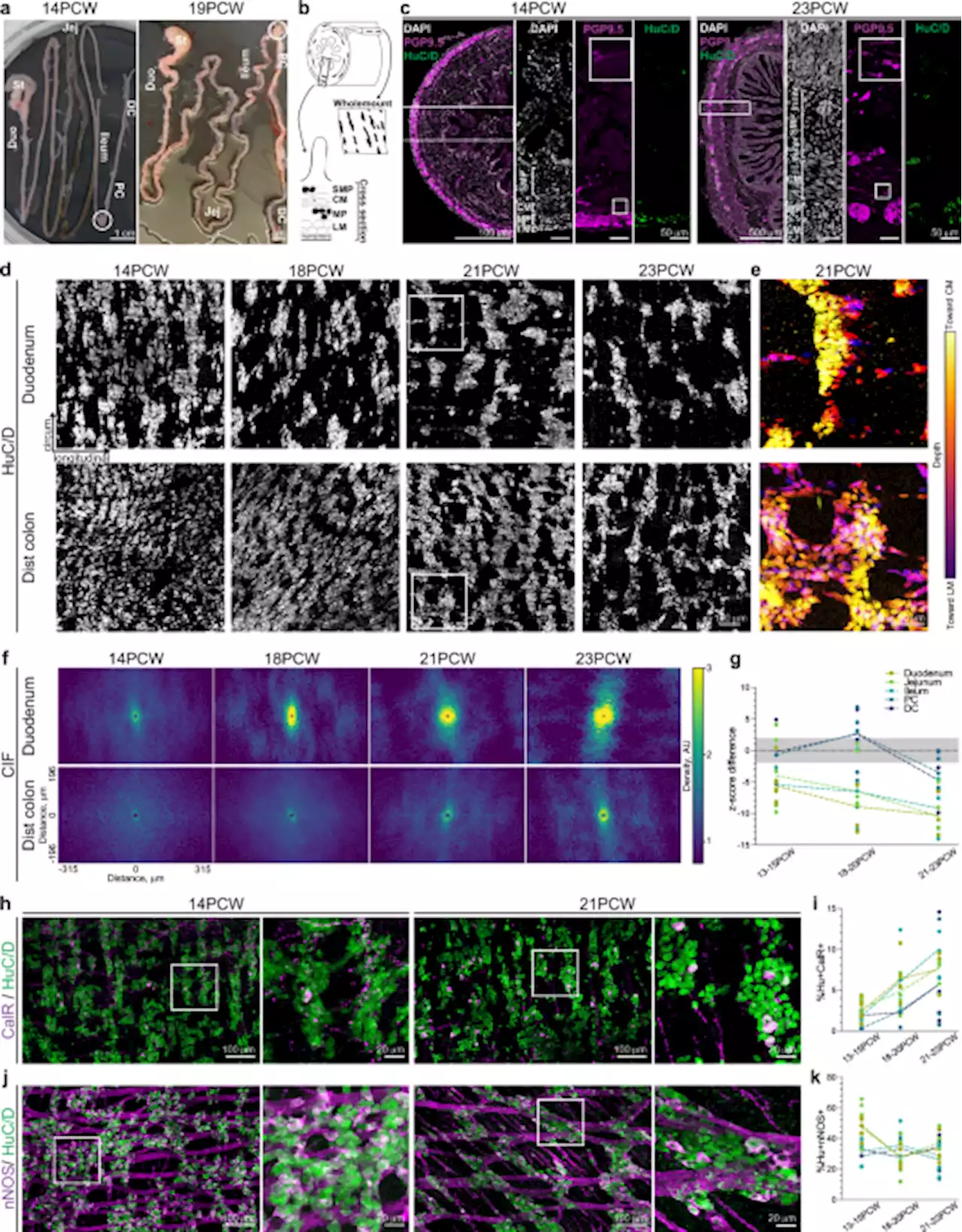 Anatomical and functional maturation of the mid-gestation human enteric nervous system - Nature Communications