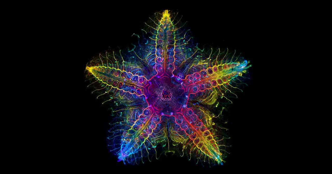 Stunning Starfish Image Wins Life Science Photo of the Year 2022