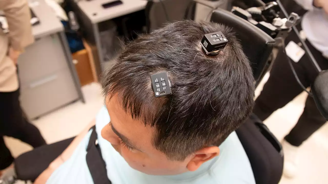 First-of-its-kind AI brain implant surgery helped a man regain feeling in his hand