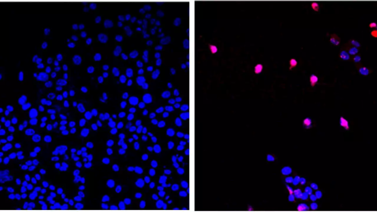 'Cancer-killing pill' that appears to 'annihilate' solid tumours is now being tested on humans