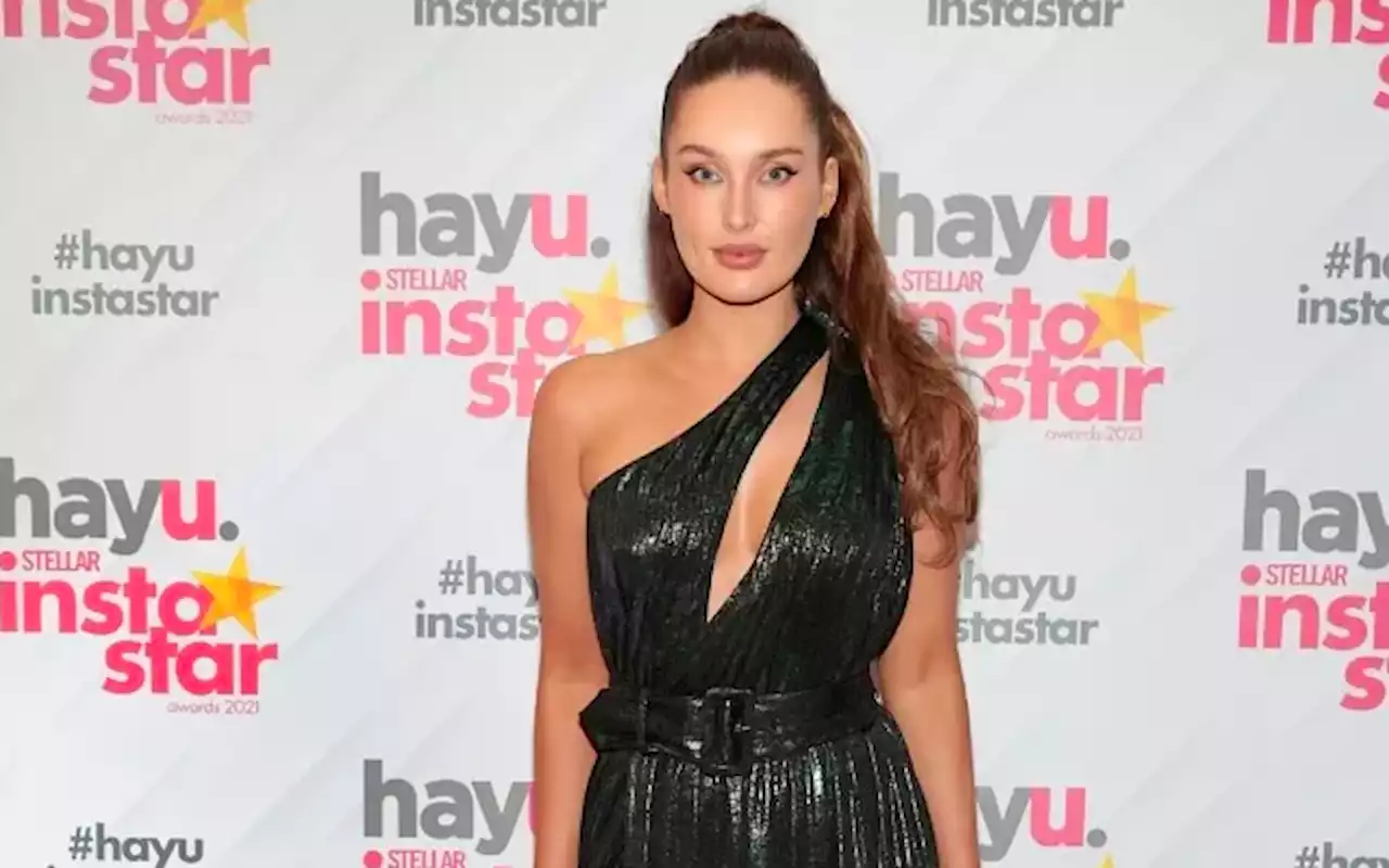 Roz Purcell Is Being Open About Her Alopecia Experience | Stellar