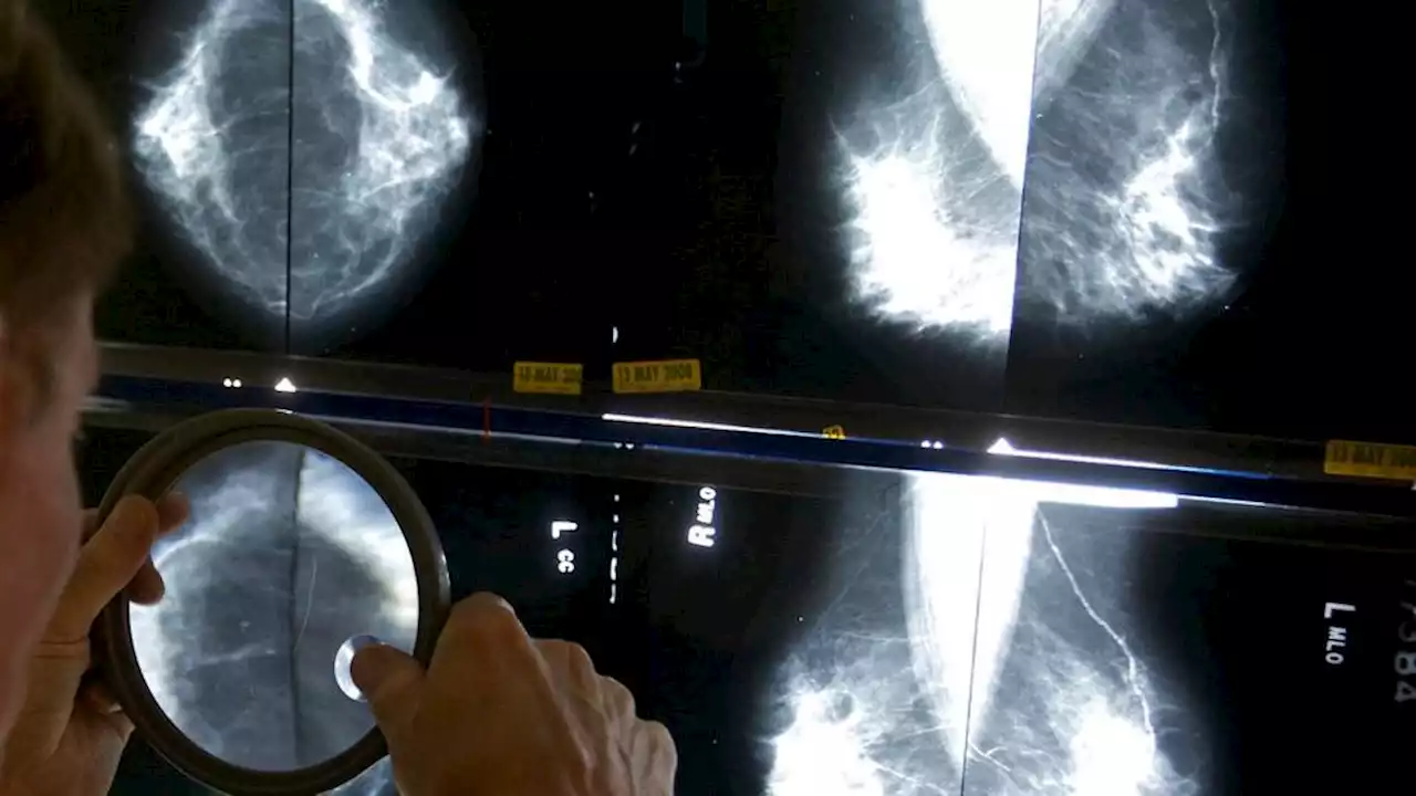 AI could cut breast cancer diagnosis time in half — study