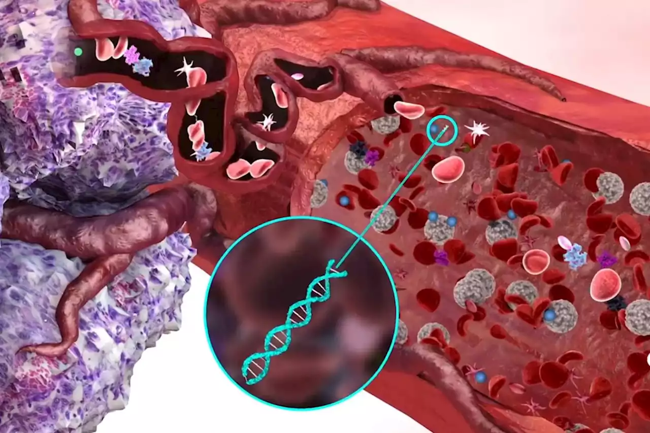 New Blood Tests May Detect Cancer Earlier