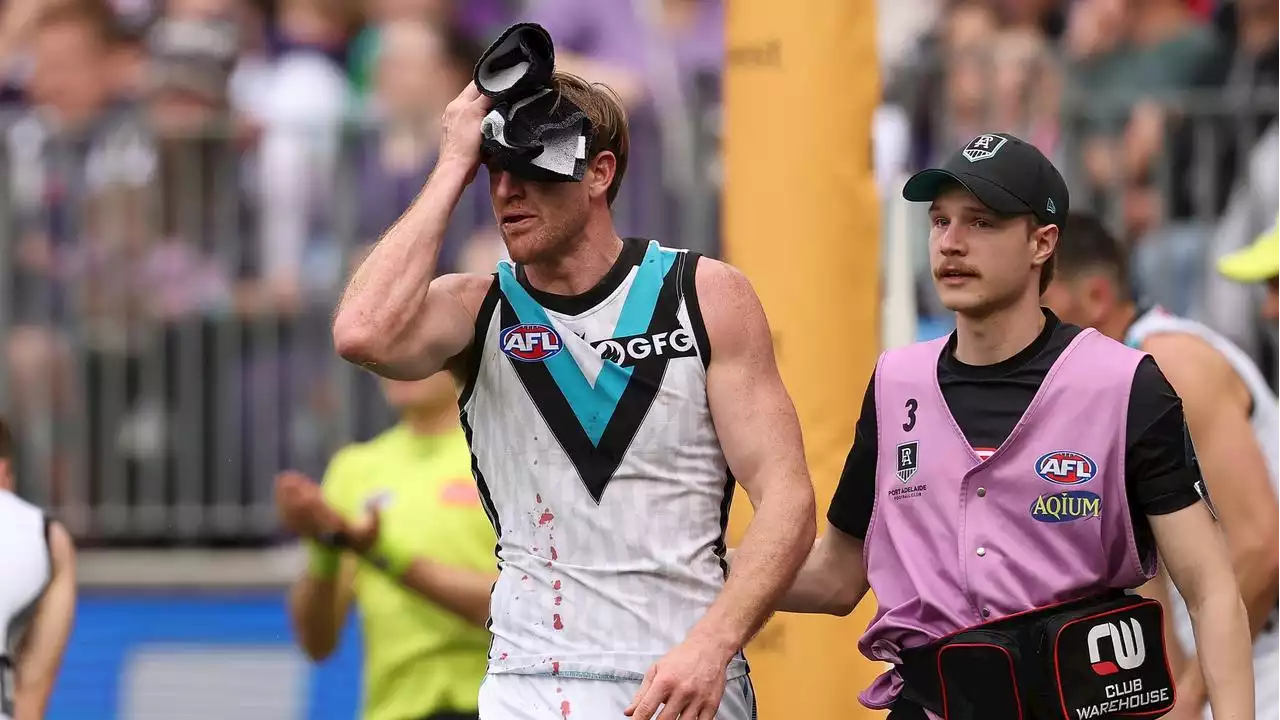 ‘Do the right thing’: Port coach explains concussion call after star tested, plays, then tested again