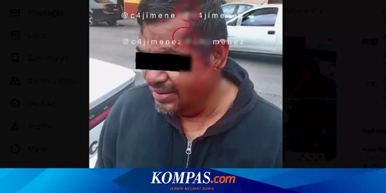 Kepala Pria di Meksiko Ditembak Dua Kali tapi Peluru Terpantul, Apa yang Terjadi?