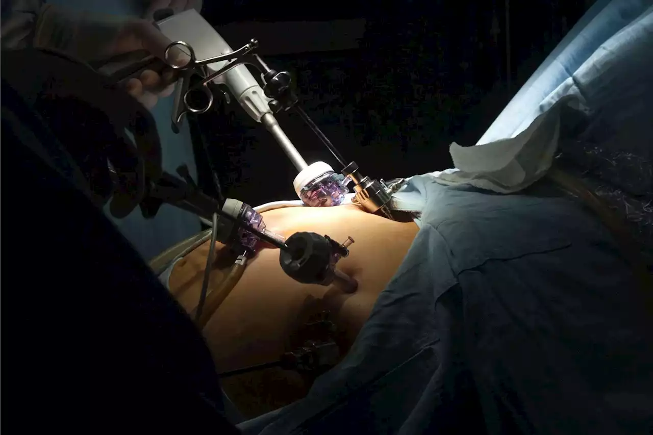 New Study Raises Questions About the Efficacy of Gastric Bypass Surgery