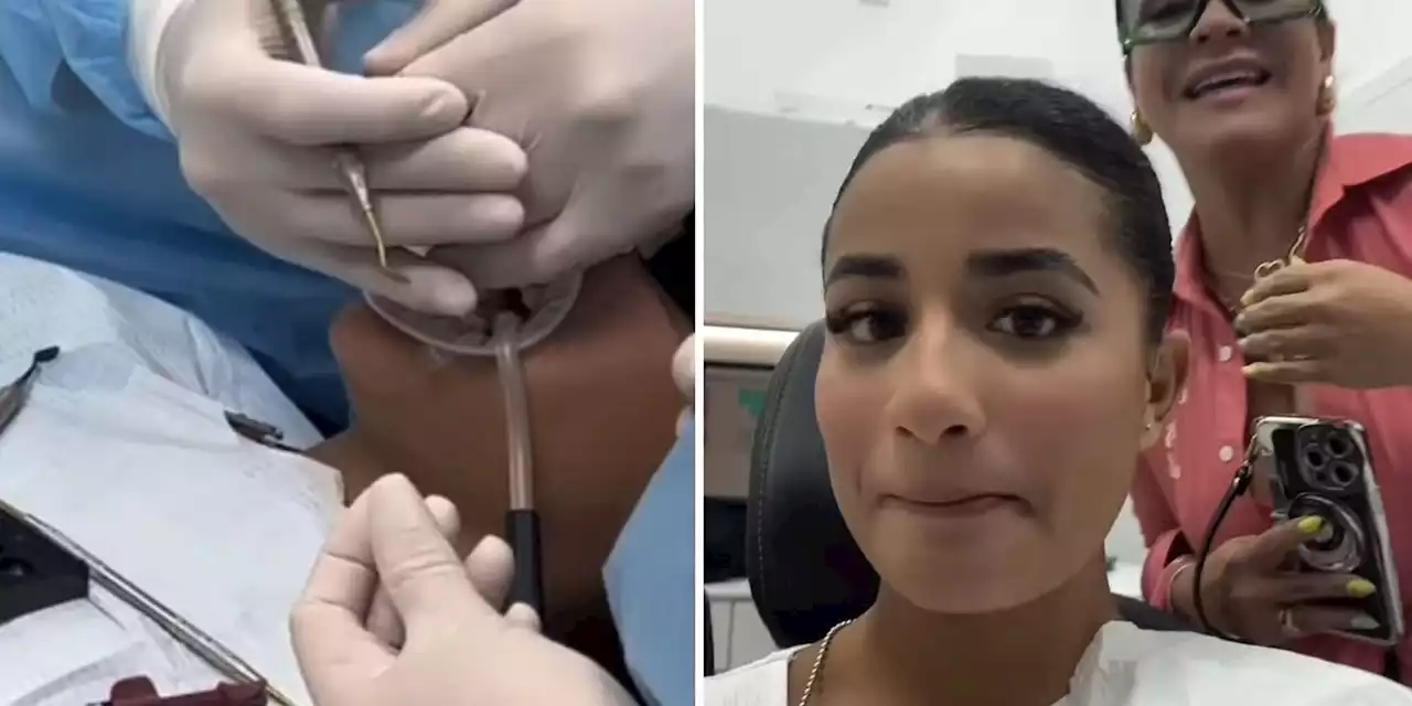 Bárbara Camila muestra sus nuevos dientes: 'Estoy feliz con el resultado'