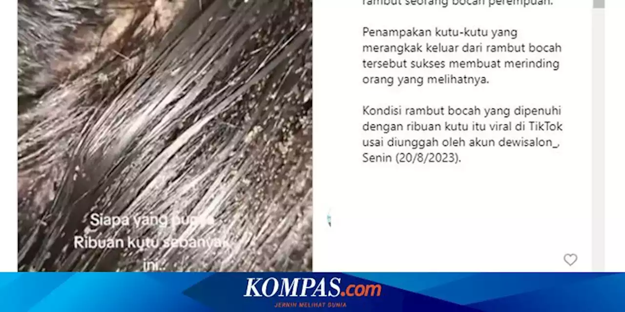 Viral, Video Ribuan Kutu Bersarang di Rambut Anak Perempuan, Ini Kata Dokter