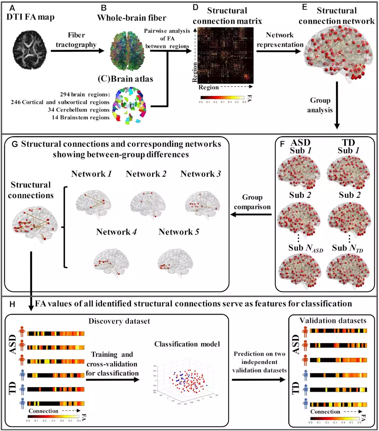 New brain connectivity biomarker offers accurate early diagnosis of autism spectrum disorder