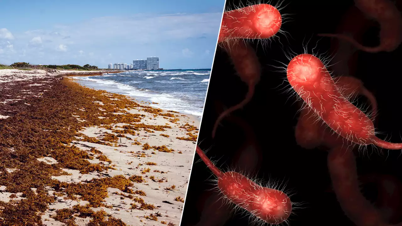 ‘Flesh-eating' bacteria found in raw shellfish and seawater linked to 5 deaths in Florida