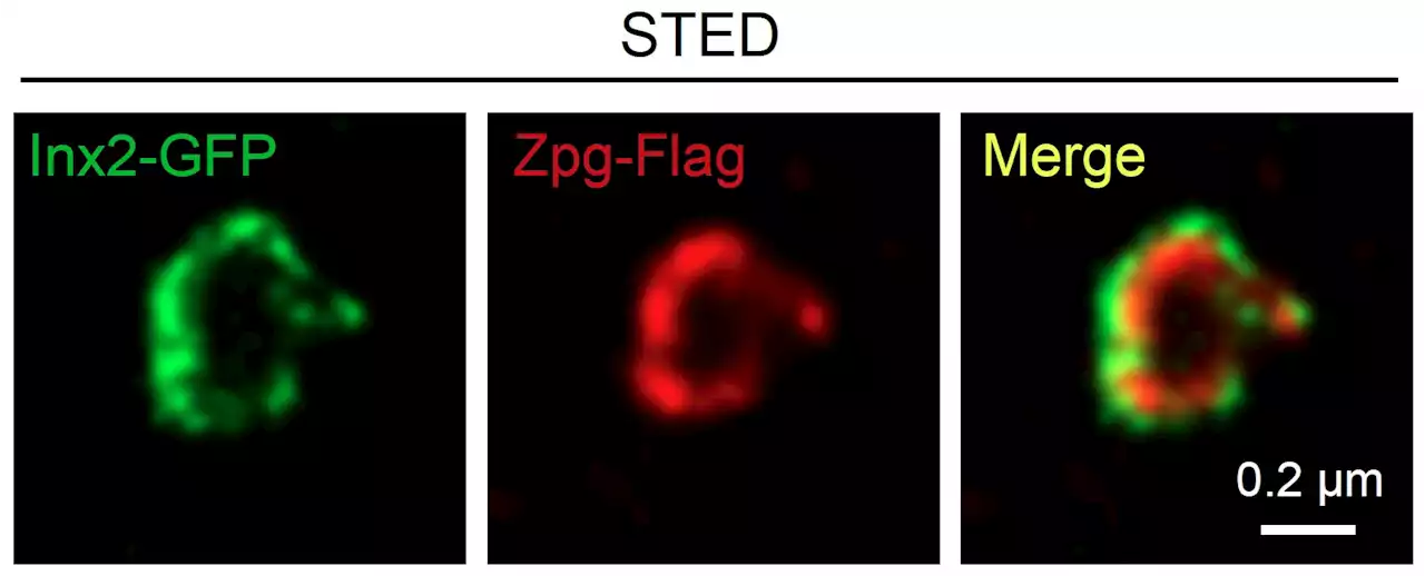 Discovery of how stem cell niche guides differentiation into functional cells is a significant step towards therapies