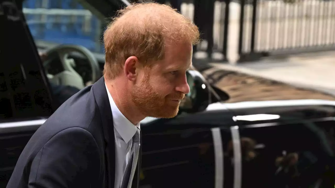 Hair loss expert reveals truth about Prince Harry’s locks