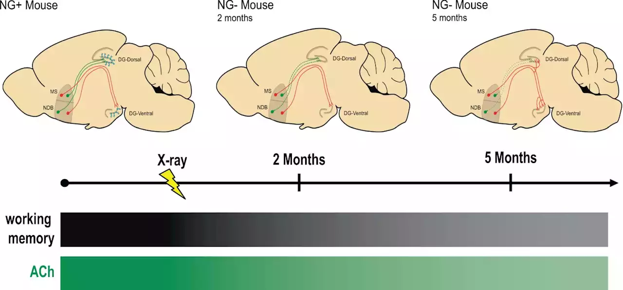 Baby neurons in adult brains are needed to maintain memory: Study