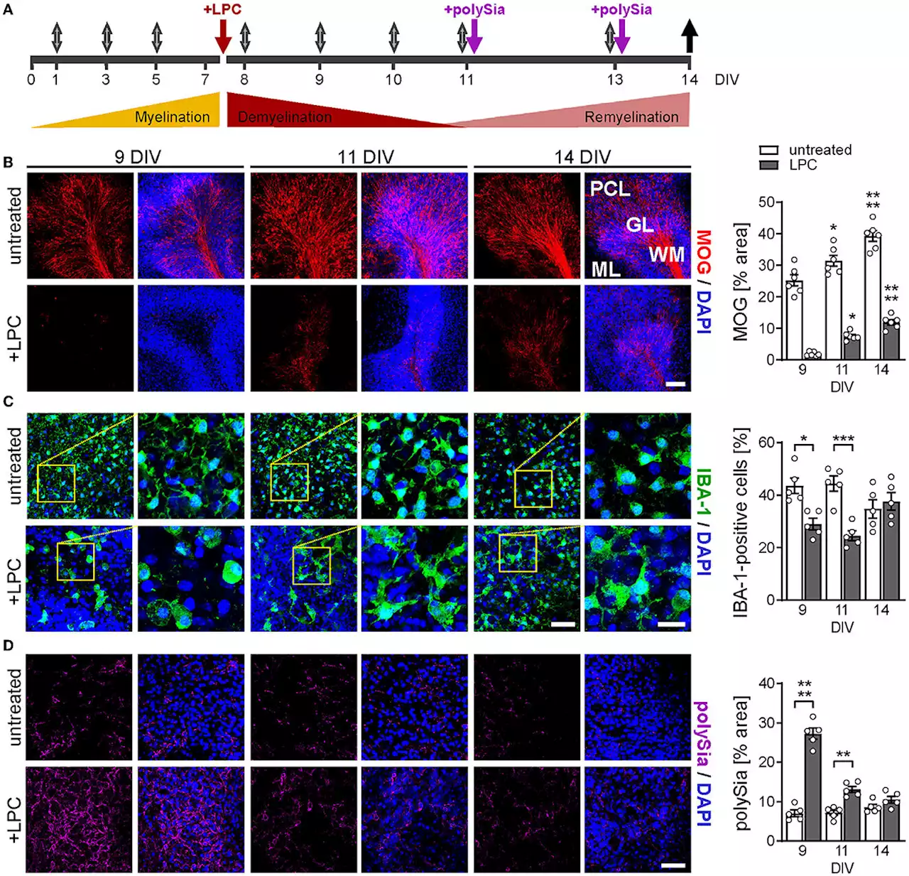 Multiple sclerosis: New approach for repairing damaged nerve sheaths