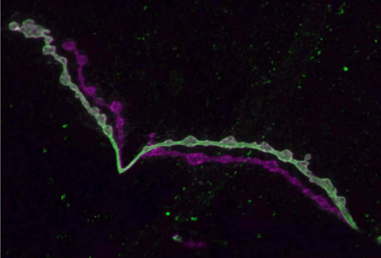 Study connects neural gene expression differences to functional distinctions