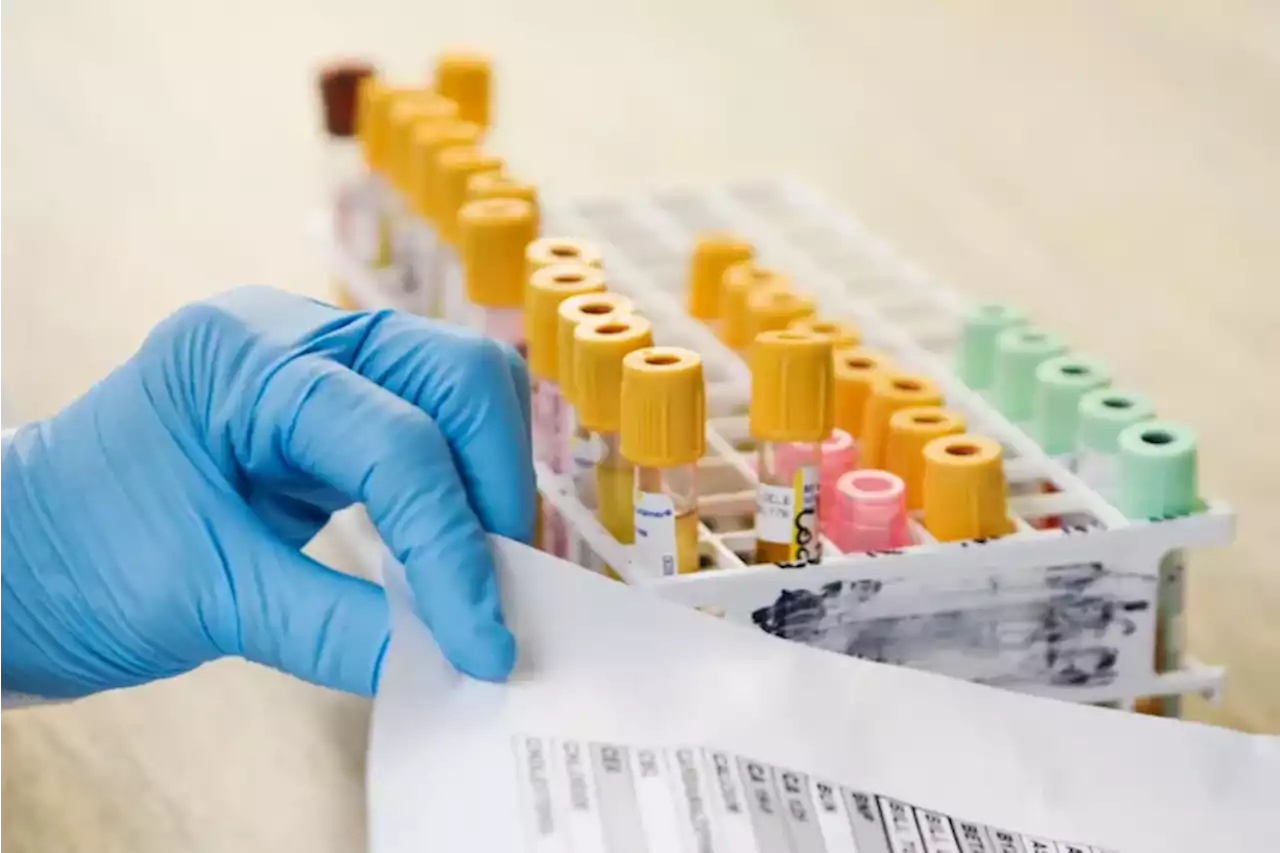 A blood test that screens for cancer: Does it do more harm than good?