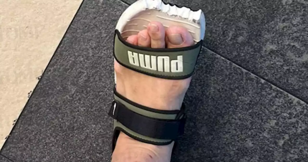 'I might have already become an amputee': Commuter's footwear chewed by escalator at Woodlands MRT station