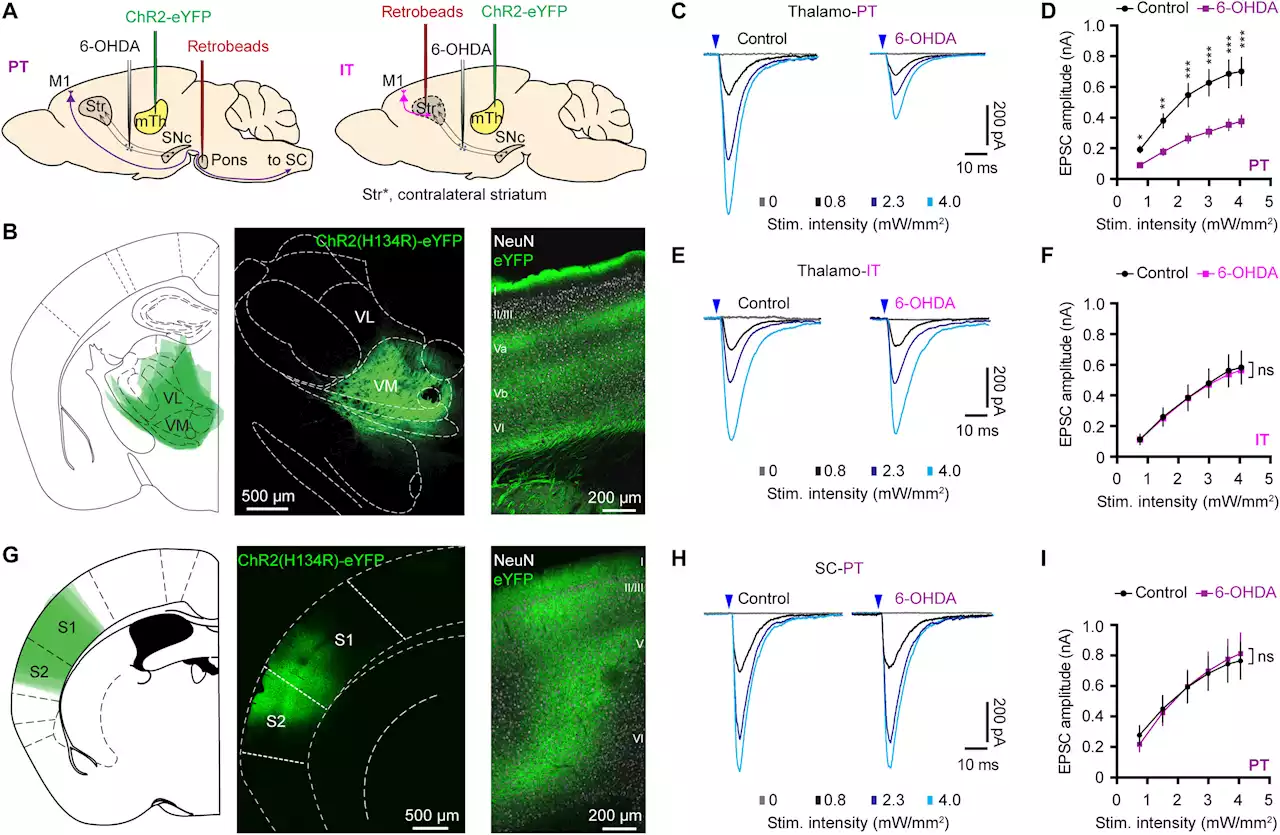 Repairing broken brain circuits may offer path to new Parkinson's treatments