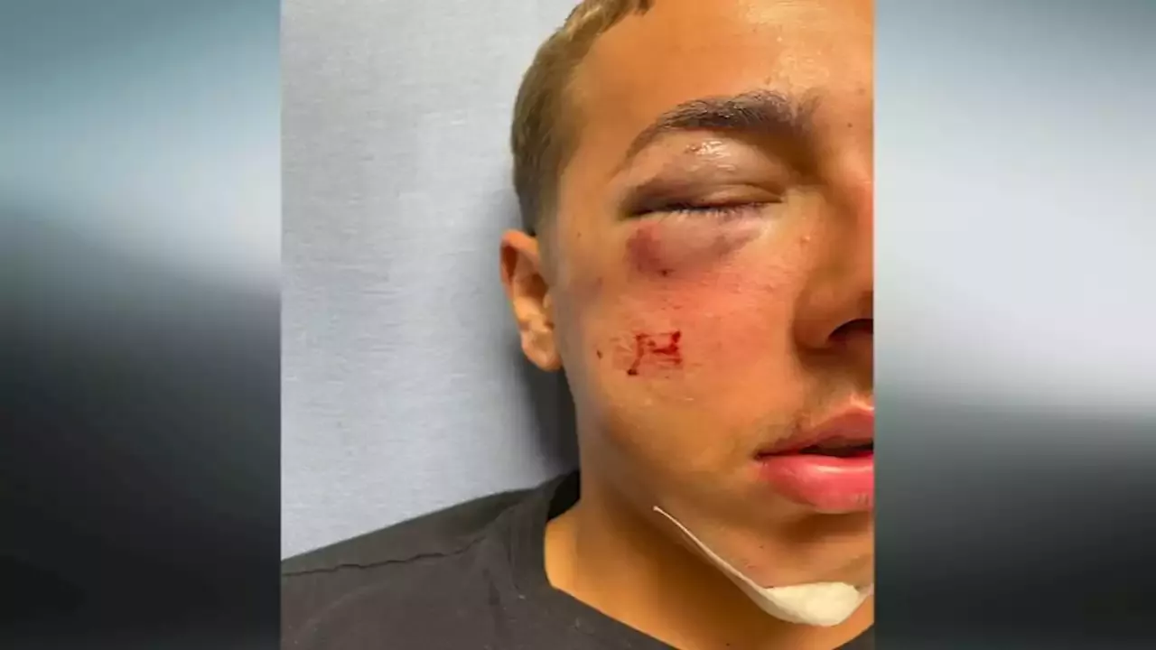 Delaware trooper suspended after 15-year-old says he was beaten while playing ding-dong-ditch