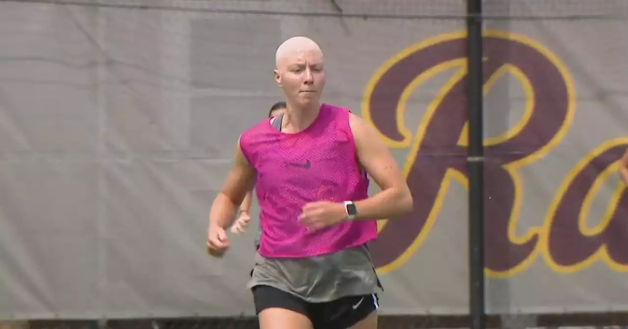 Loyola soccer captain's battle with alopecia inspires teammates