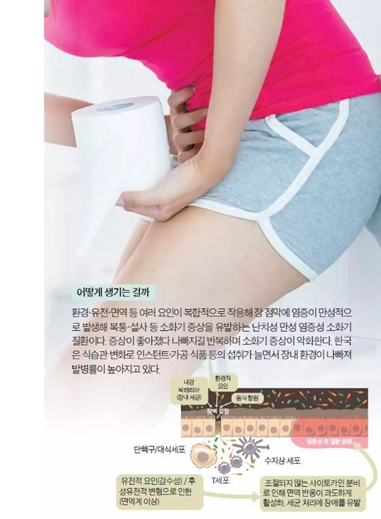 중요할 때 꼭...화장실 급해 면접·시험 망치는 1020 봐야할 기사 [건강한 가족]