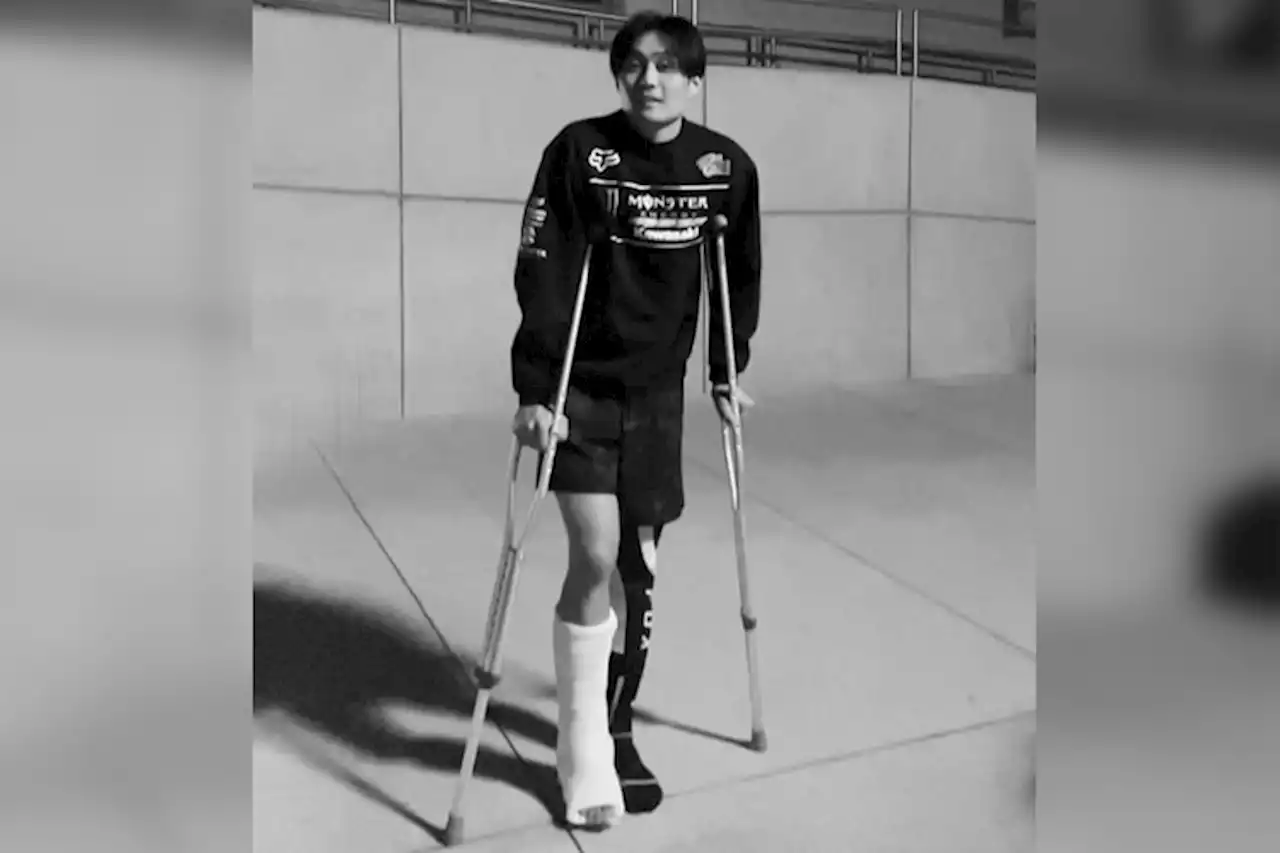 Jo Shimoda (Kawasaki) verletzt: Rechtes Bein in Gips