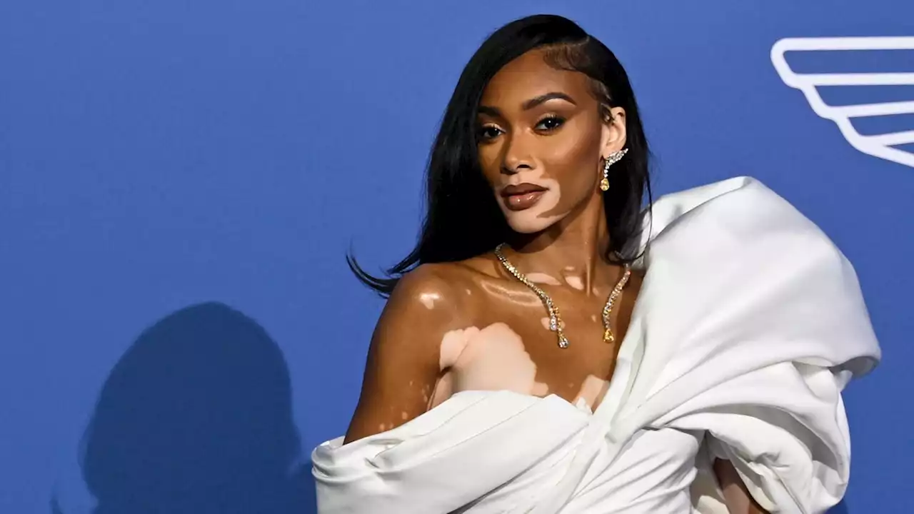 Winnie Harlow ganz privat: So lebt das Supermodel in seinem Hollywood-Haus in L.A.