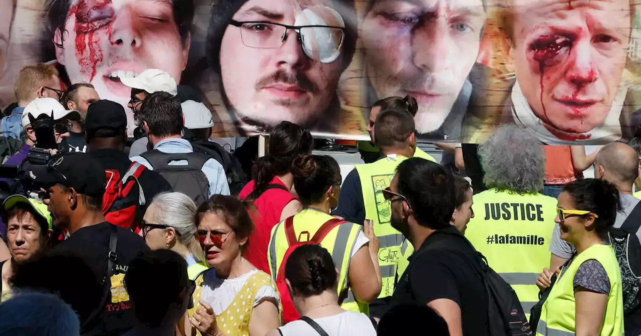 Gilets jaunes blessés par des tirs de LBD : des scientifiques publient des «résultats préoccupants»